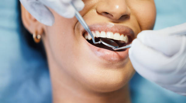 Best Emergency Tooth Extraction in Red Bud, IL